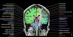 Human Brain MRI