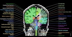 Human Brain MRI