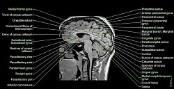 ★ DD : Disclaimerized Depiction ; ★   Hi ! TAENIA (Human BRAIN MRI)