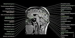 ★ DD : Disclaimerized Depiction ; ★   Hi ! TAENIA (Human BRAIN MRI)