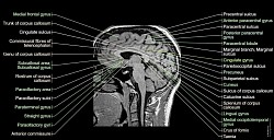 ★ DD : Disclaimerized Depiction ; ★   Hi ! TAENIA (Human BRAIN MRI)